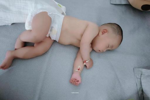 陆丰宝宝头上长痱子